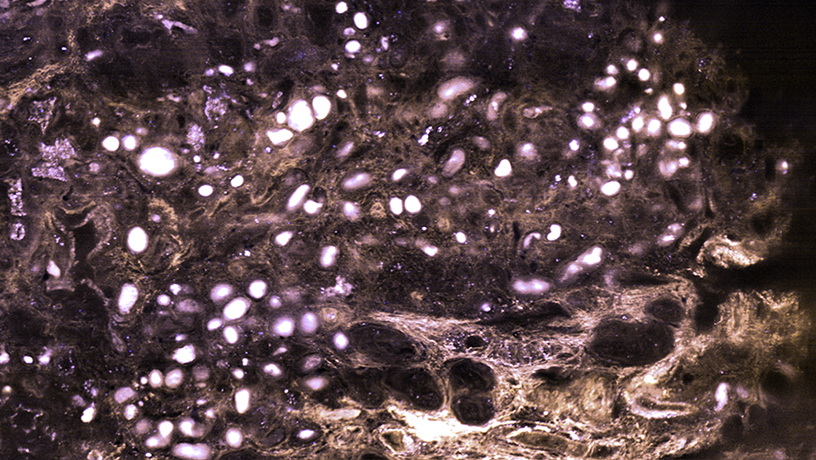 Kidney slice